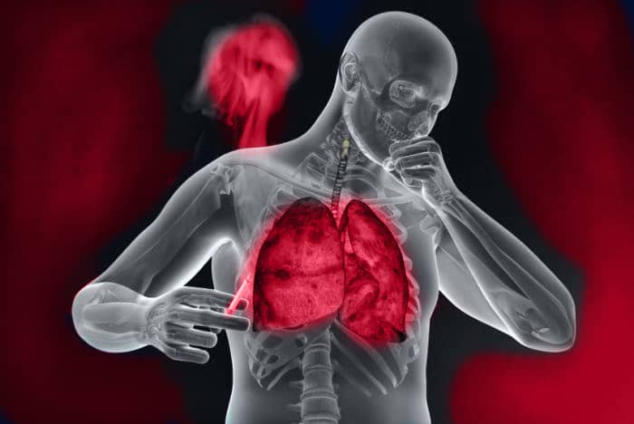 chronic obstructive pulmonary disease, COPD, Genesisdx